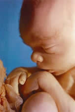 20 wk. Unborn Baby